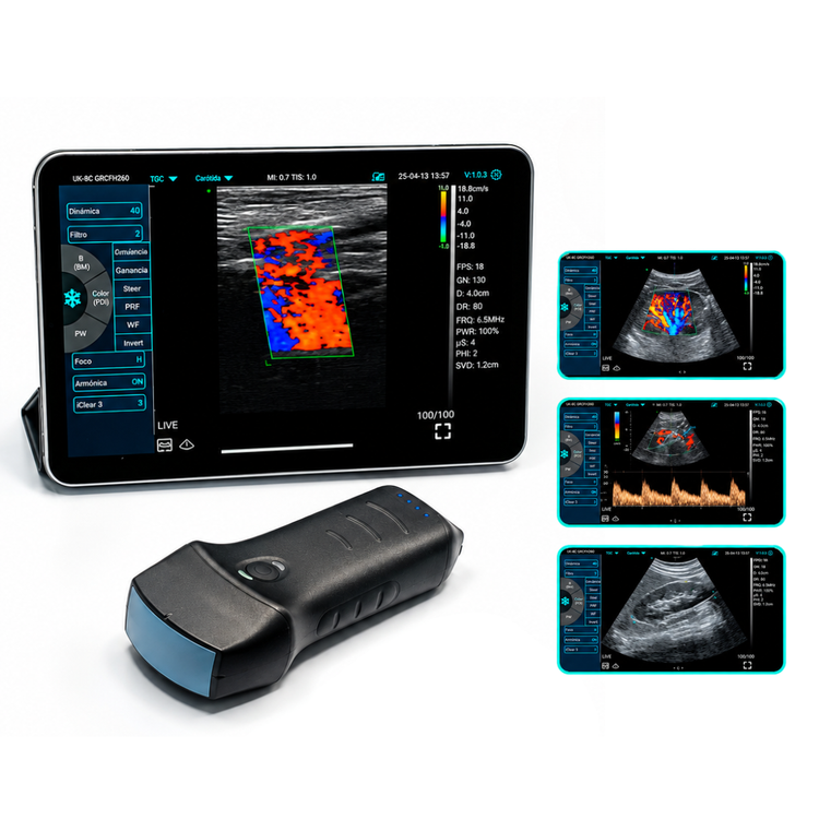Ultrasonido Portátil WiFi Dual PRO 3 en 1  Doppler Color y PW Convexo y Lineal Inalámbrico