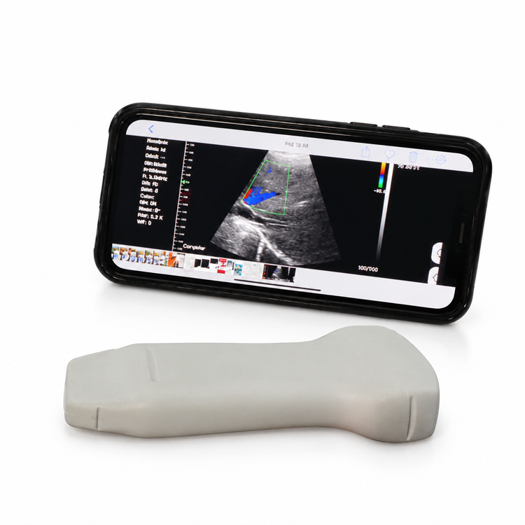 Ultrasonido Portátil WiFi 3 en 1 con Doppler Color | Convexo, Lineal y Sectorial