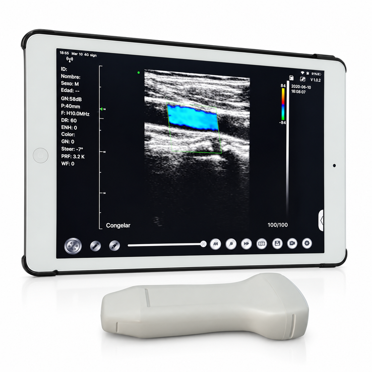 Ultrasonido Portátil WiFi 3 en 1 con Doppler Color | Convexo, Lineal y Sectorial